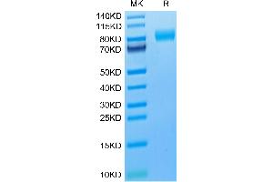 Cynomolgus M-CSF R on Tris-Bis PAGE under reduced condition. (CSF1R Protein (AA 99-596) (His tag))