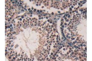 DAB staining on IHC-P; Samples: Mouse Testis Tissue (FKBP10 抗体  (AA 316-573))