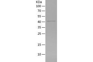 Western Blotting (WB) image for Alanyl (Membrane) Aminopeptidase (ANPEP) (AA 34-381) protein (His tag) (ABIN7282848) (CD13 Protein (AA 34-381) (His tag))