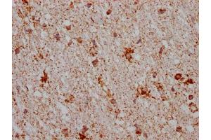 IHC image of ABIN7127628 diluted at 1:100 and staining in paraffin-embedded human brain tissue performed on a Leica BondTM system. (Recombinant Monoamine Oxidase B 抗体)