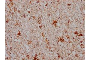 IHC image of ABIN7127628 diluted at 1:100 and staining in paraffin-embedded human brain tissue performed on a Leica BondTM system.