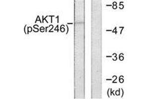 Western blot analysis of extracts from HeLa cells treated with Etoposide 25uM 24h, using Akt (Phospho-Ser246) Antibody. (AKT1 抗体  (pSer246))