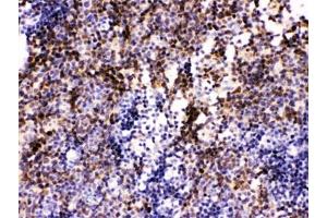 IHC testing of FFPE mouse lymph node with PAX2 antibody. (PAX2A 抗体)
