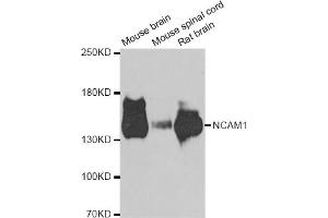 Western blot analysis of extracts of various cell lines, using NCAM1 antibody (ABIN5975670) at 1/1000 dilution. (CD56 抗体)