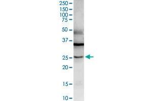Western Blotting (WB) image for anti-Galectin 3 (LGALS3) (AA 1-250) antibody (ABIN517488)