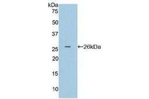 Detection of Recombinant FcgRI, Human using Polyclonal Antibody to Cluster Of Differentiation 64 (CD64) (FCGR1A 抗体  (AA 35-235))