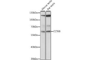 Western blot analysis of extracts of various cell lines, using CCT6B antibody (ABIN7270709) at 1:1000 dilution. (CCT6B 抗体  (AA 120-340))