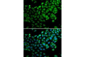Immunofluorescence analysis of A-549 cells using SYNCRIP antibody.