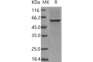 Western Blotting (WB) image for Mannose-Binding Lectin (Protein A) 1 (Mbl1) protein (Fc Tag) (ABIN7321168) (Mbl1 Protein (Fc Tag))