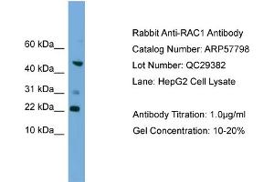 WB Suggested Anti-RAC1  Antibody Titration: 0. (RAC1 抗体  (Middle Region))