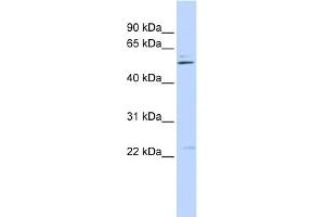 WB Suggested Anti-TRIM35 Antibody Titration:  0. (TRIM35 抗体  (Middle Region))