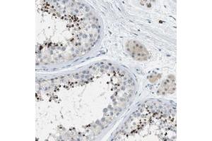 Immunohistochemical staining of human testis with C9orf11 polyclonal antibody  shows strong cap like cytoplasmic positivity in spermatids at 1:200-1:500 dilution. (C9orf11 抗体)