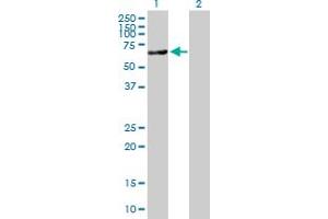 Western Blot analysis of ACSS2 expression in transfected 293T cell line by ACSS2 MaxPab polyclonal antibody. (ACSS2 抗体  (AA 1-606))