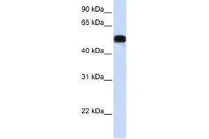 WB Suggested Anti-FOXA1 Antibody Titration: 0. (FOXA1 抗体  (N-Term))
