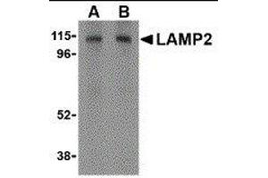 Western Blotting (WB) image for anti-Lysosomal-Associated Membrane Protein 2 (LAMP2) (C-Term) antibody (ABIN2478099) (LAMP2 抗体  (C-Term))