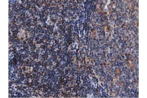 Immunohistochemical staining of paraffin-embedded Human lymph node tissue using anti-ARHGAP25 mouse monoclonal antibody. (ARHGAP25 抗体)
