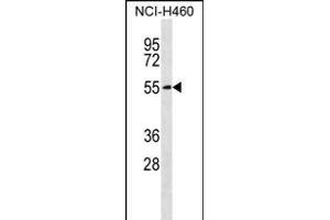 Western Blotting (WB) image for anti-Solute Carrier Family 16 (Monocarboxylic Acid Transporters), Member 3 (SLC16A3) (AA 433-462), (C-Term) antibody (ABIN656331)
