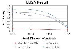 Red: Control Antigen (100 ng), Purple: Antigen (10 ng), Green: Antigen (50 ng), Blue: Antigen (100 ng), (Lamin A/C 抗体)