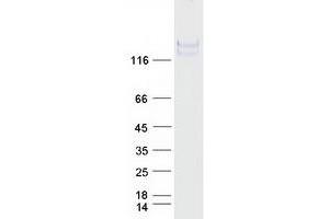 Western Blotting (WB) image for Neurofilament Triplet M Protein (NEFM) (Transcript Variant 1) protein (Myc-DYKDDDDK Tag) (ABIN2727137)
