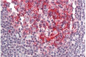 Human Small Intestine, Peyer's Patch (formalin-fixed, paraffin-embedded) stained with BIRC8 antibody ABIN214413 at 5 ug/ml followed by biotinylated goat anti-rabbit IgG secondary antibody ABIN481713, alkaline phosphatase-streptavidin and chromogen. (ILP-2 抗体  (N-Term))