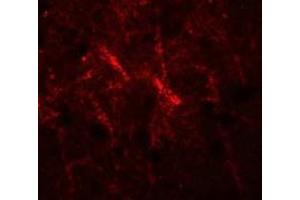 Immunofluorescence of SIPA1 in human brain cells with SIPA1 antibody at 20 ug/mL. (SIPA1 抗体  (N-Term))