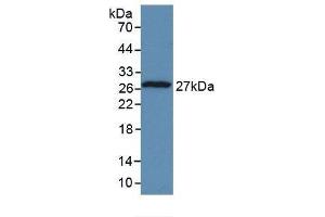 Detection of Recombinant TPT1, Human using Monoclonal Antibody to Tumor Protein, Translationally Controlled 1 (TPT1) (TPT1 抗体  (AA 1-172))