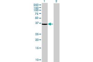 Western Blot analysis of EPM2A expression in transfected 293T cell line ( H00007957-T01 ) by EPM2A MaxPab polyclonal antibody. (EPM2A 抗体  (AA 1-331))