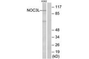 Western blot analysis of extracts from K562 cells, using NOC3L Antibody. (NOC3L 抗体  (AA 415-464))