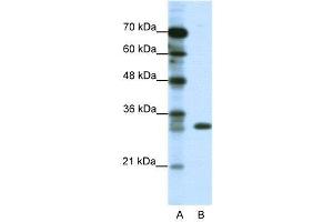 WB Suggested Anti-TSFM  Antibody Titration: 1. (TSFM 抗体  (C-Term))
