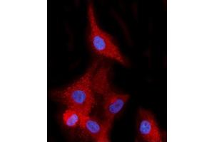 anti-EH-Domain Containing 2 (EHD2) (Middle Region) antibody
