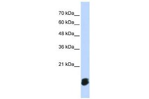 GLRX5 antibody used at 1 ug/ml to detect target protein. (GLRX5 抗体  (Middle Region))