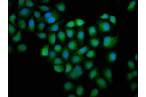 Immunofluorescence staining of Hela cells with ABIN7153749 at 1:100, counter-stained with DAPI. (Gelsolin 抗体  (AA 28-782))