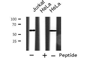 Western blot analysis of extracts from Jurkat/HeLa cells, using CYP2A6V2 antibody. (Cytochrome P450 2A6V2 抗体)
