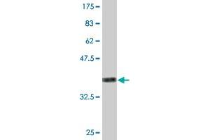 Western Blot detection against Immunogen (36. (RAB11FIP5 抗体  (AA 554-652))