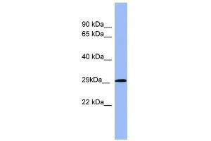 WB Suggested Anti-RAB5A Antibody Titration: 0. (RAB5 抗体  (Middle Region))