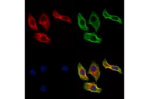 ABIN6264216 and ABIN6273297 staining Hela cells by IF/ICC. (PIK3IP1 抗体  (N-Term))