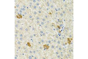 Immunohistochemistry of paraffin-embedded mouse liver using HSPA9 antibody. (HSPA9 抗体  (AA 380-679))