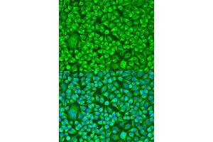 Immunofluorescence analysis of U2OS cells using TUBB8 antibody. (Tubulin, beta 8 抗体)