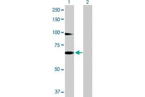 Western Blot analysis of RNF12 expression in transfected 293T cell line by RNF12 MaxPab polyclonal antibody. (RLIM 抗体  (AA 1-624))