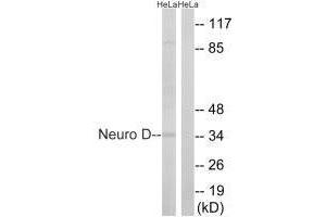 Western blot analysis of extracts from HeLa cells, using Neuro D (Ab-274) antibody. (NEUROD1 抗体  (Ser272))