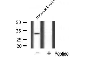 Western blot analysis of extracts from mouse brain, using Mlx antibody. (MLX 抗体  (Internal Region))