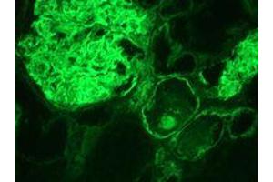 Immunohistochemistry on frozen section of human kidney (Integrin alpha 3a 抗体)