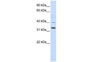Crystallin Zeta antibody used at 1 ug/ml to detect target protein. (CRYZ 抗体)
