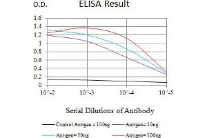 Black line: Control Antigen (100 ng),Purple line: Antigen (10 ng), Blue line: Antigen (50 ng), Red line:Antigen (100 ng) (KAT6B 抗体  (AA 1186-1318))