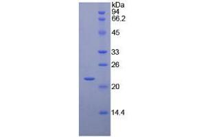 SDS-PAGE analysis of Chicken Interferon beta Protein.