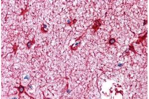 Human Brain, Cortex: Formalin-Fixed, Paraffin-Embedded (FFPE) (GFAP 抗体)