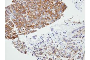 Immunohistochemistry (IHC) image for anti-phosphoribosyl Pyrophosphate Synthetase-Associated Protein 2 (PRPSAP2) antibody (ABIN2856518)
