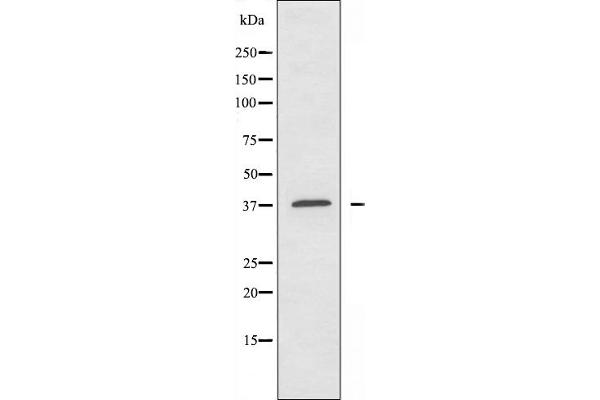 ATP6AP2 抗体  (Internal Region)