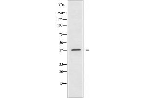Western blot analysis of extracts from COLO205 cells using Caper antibody. (ATP6AP2 抗体  (Internal Region))