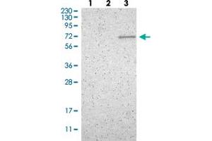 Western blot analysis of Lane 1: Human cell line RT-4 Lane 2: Human cell line U-251MG sp Lane 3: Human plasma (IgG/HSA depleted)  with ZNF37A polyclonal antibody  at 1:100-1:250 dilution. (ZNF37A 抗体)